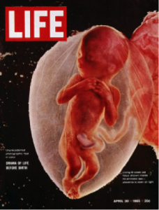 life fetus cover